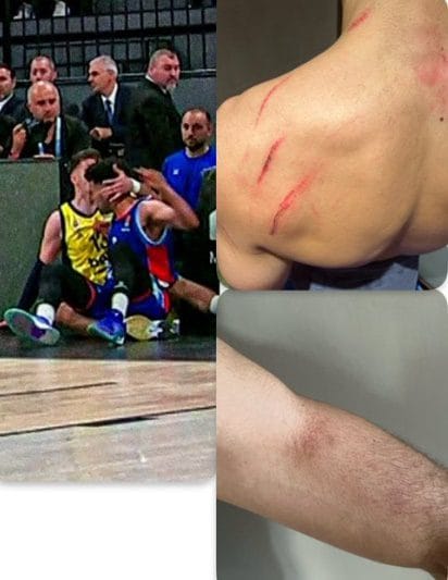Elijah Bryant: Biberovic'i Isırmadım, O Beni Aşağı Çekti